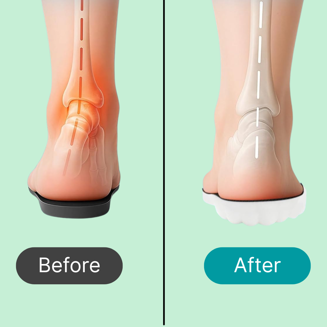 StepRelief Insoles